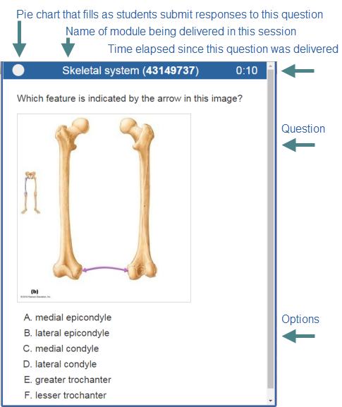 Student window includes pie chart of responses, name of module, elapsed time, question, and answer options